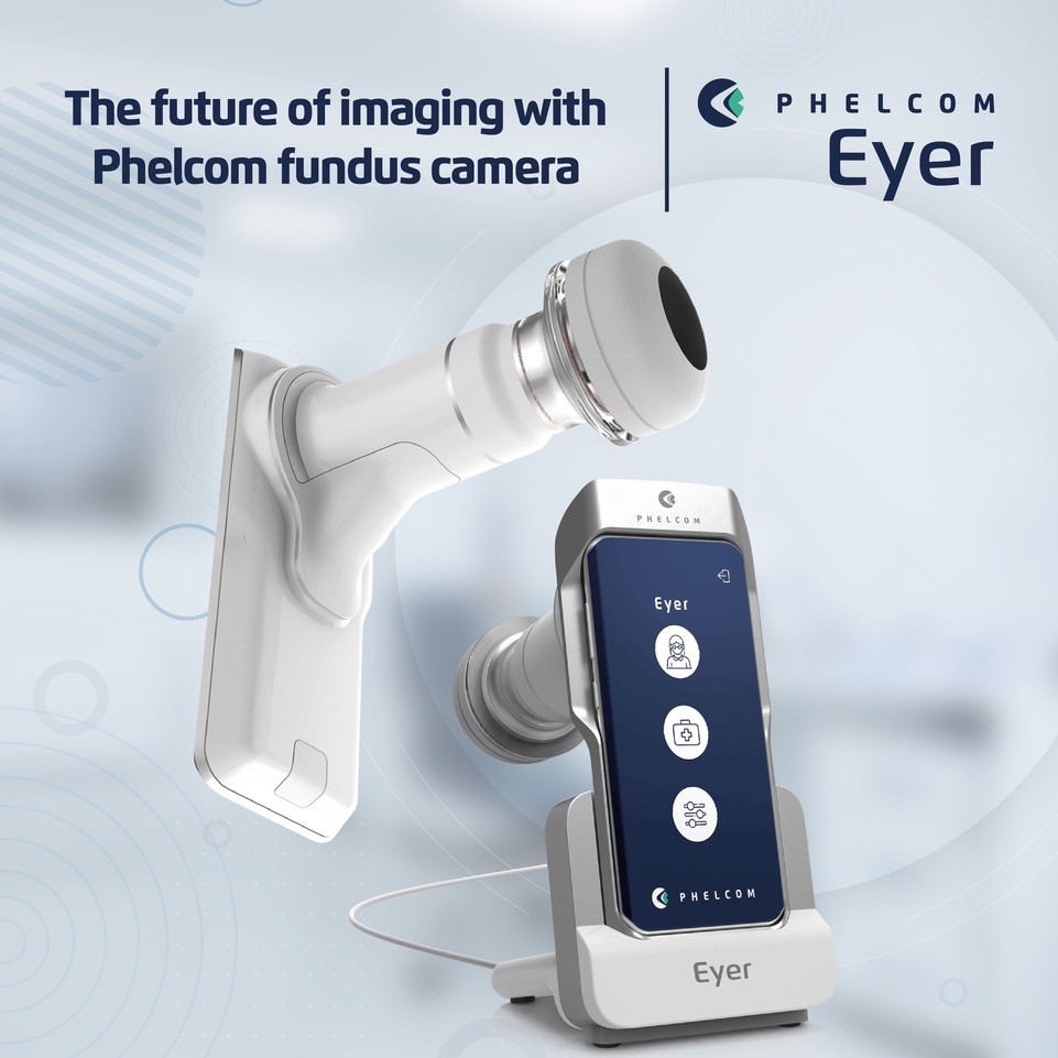 Phelcom Retinal Camera Financing